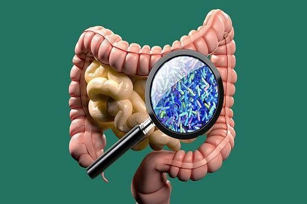 منشاء بیماری آلزایمر در روده هاست